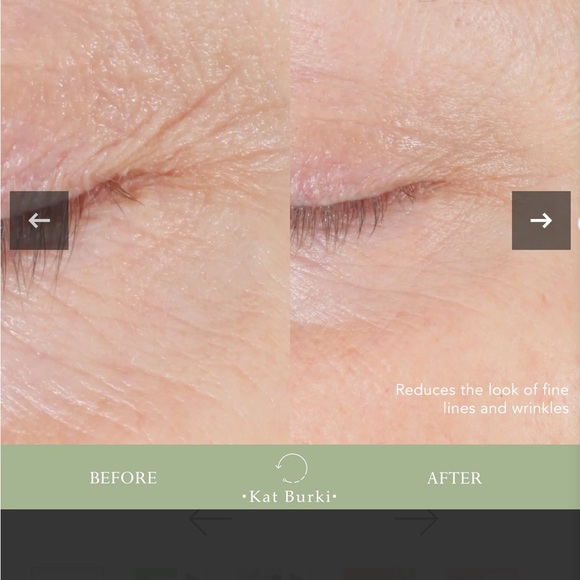 BNIB REVERSAL LIFT & FILL FORM CONTROL MARINE COLLAGEN GEL BY KAT BURKI - Picture 5 of 9